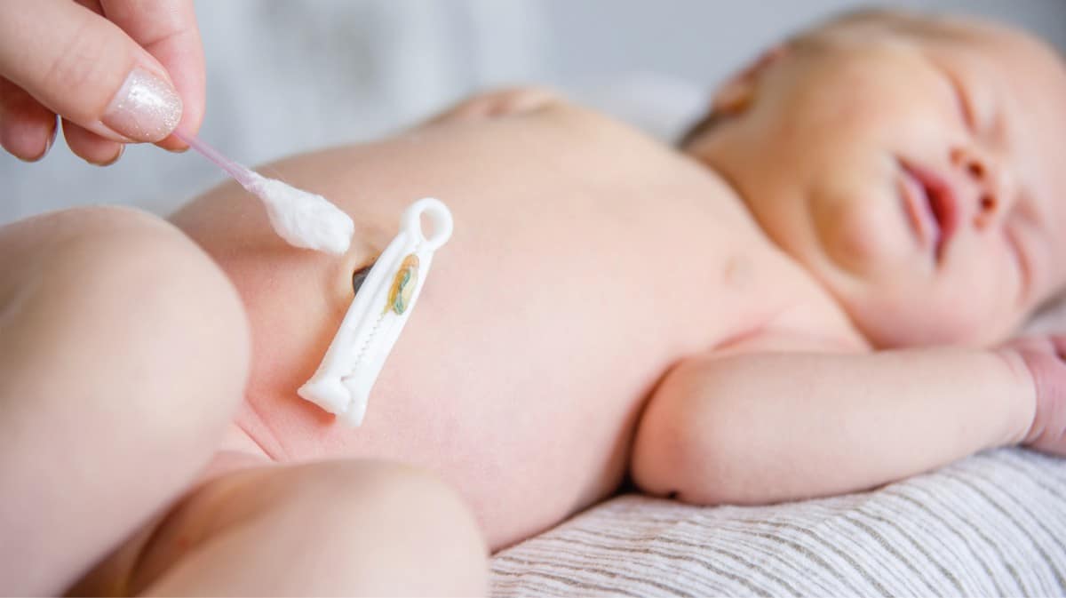 Ooit Thermisch Verdeelstuk Afnavelen: navelklem, navelveter of cordring - wat is het beste voor je  baby? - Holy Mom